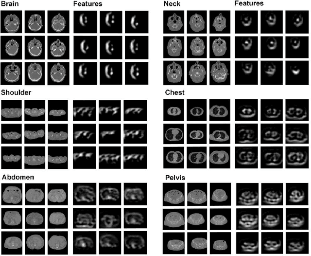 Figure 4 for How much data is needed to train a medical image deep learning system to achieve necessary high accuracy?