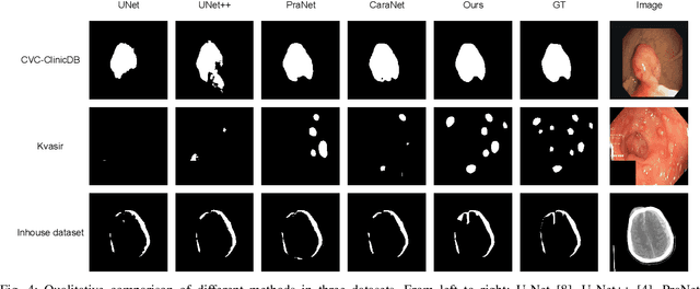 Figure 4 for CM-MLP: Cascade Multi-scale MLP with Axial Context Relation Encoder for Edge Segmentation of Medical Image