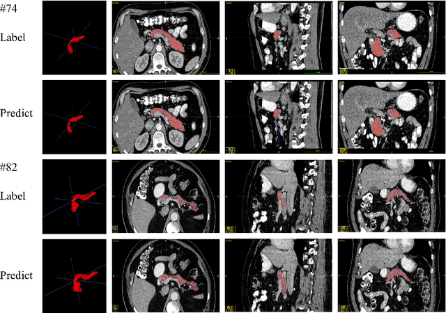 Figure 3 for Dynamic Linear Transformer for 3D Biomedical Image Segmentation