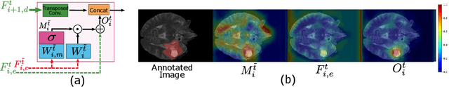Figure 3 for Unified Attentional Generative Adversarial Network for Brain Tumor Segmentation From Multimodal Unpaired Images