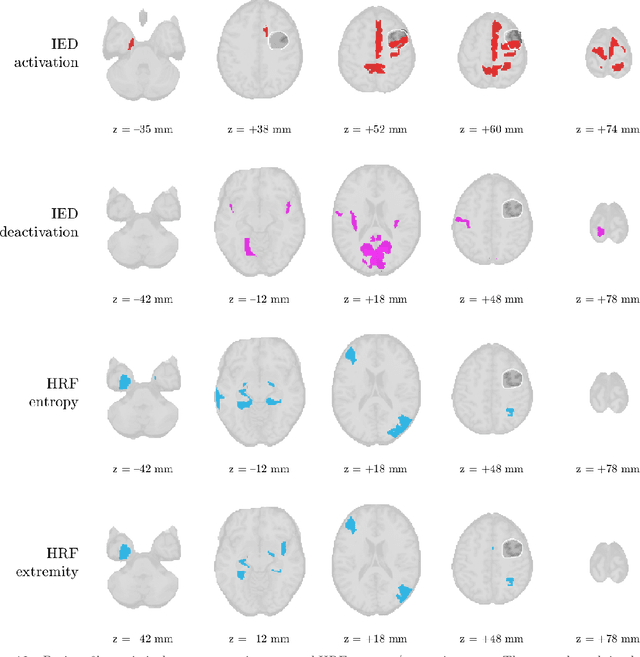 Figure 4 for Augmenting interictal mapping with neurovascular coupling biomarkers by structured factorization of epileptic EEG and fMRI data