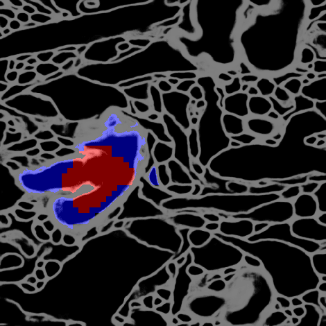 Figure 4 for Morphological Error Detection in 3D Segmentations