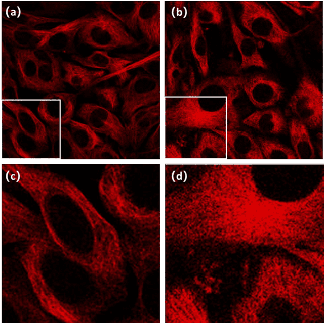 Figure 2 for Super-resolution reconstruction of cytoskeleton image based on A-net deep learning network