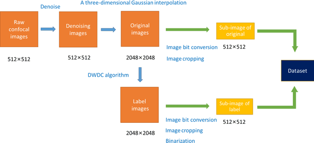 Figure 3 for Super-resolution reconstruction of cytoskeleton image based on A-net deep learning network