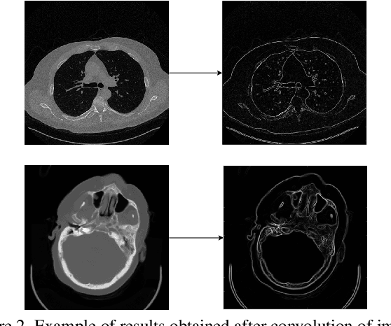 Figure 3 for Eformer: Edge Enhancement based Transformer for Medical Image Denoising