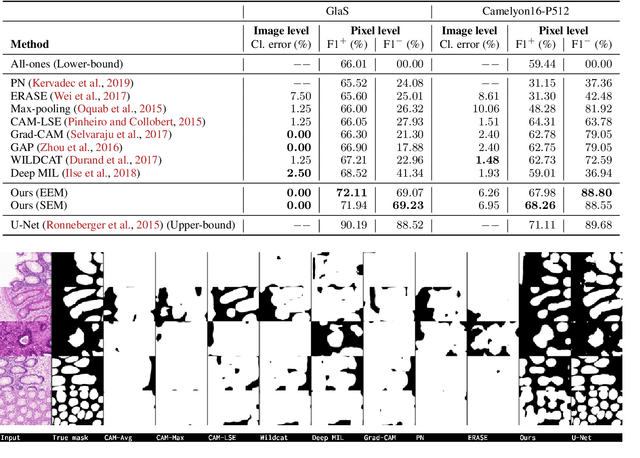 Figure 2 for Leveraging Uncertainty for Deep Interpretable Classification and Weakly-Supervised Segmentation of Histology Images