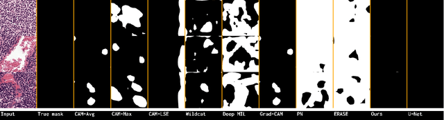 Figure 3 for Leveraging Uncertainty for Deep Interpretable Classification and Weakly-Supervised Segmentation of Histology Images