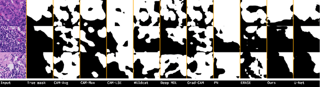 Figure 4 for Leveraging Uncertainty for Deep Interpretable Classification and Weakly-Supervised Segmentation of Histology Images