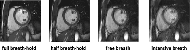 Figure 1 for Cardiac Segmentation using Transfer Learning under Respiratory Motion Artifacts