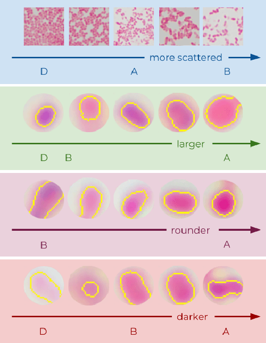 Figure 1 for Classifying bacteria clones using attention-based deep multiple instance learning interpreted by persistence homology