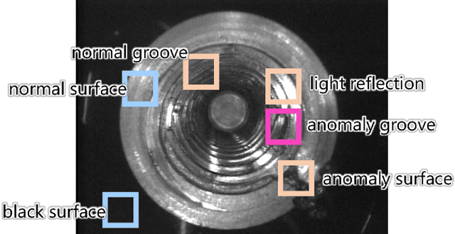 Figure 1 for Deep Generative Model using Unregularized Score for Anomaly Detection with Heterogeneous Complexity
