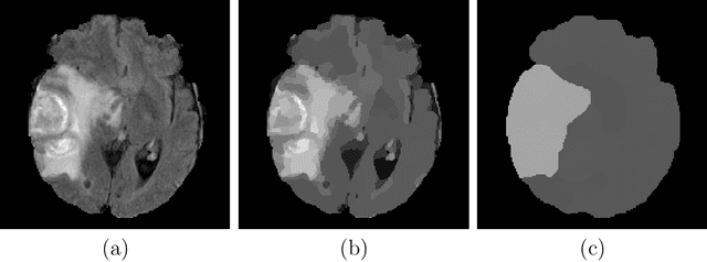 Figure 1 for Robustness of Brain Tumor Segmentation