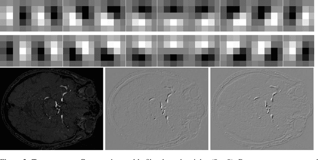 Figure 3 for Generative Adversarial Training for MRA Image Synthesis Using Multi-Contrast MRI