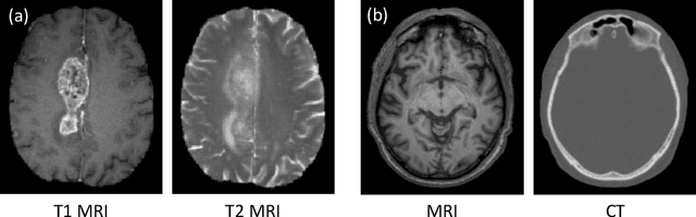 Figure 1 for Dual Adversarial Learning with Attention Mechanism for Fine-grained Medical Image Synthesis