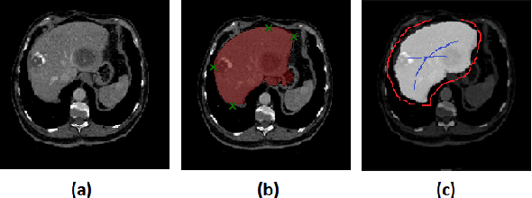 Figure 1 for Interactive Deep Refinement Network for Medical Image Segmentation