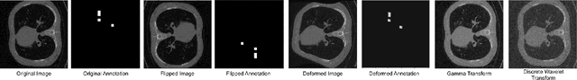 Figure 3 for Spectral Data Augmentation Techniques to quantify Lung Pathology from CT-images