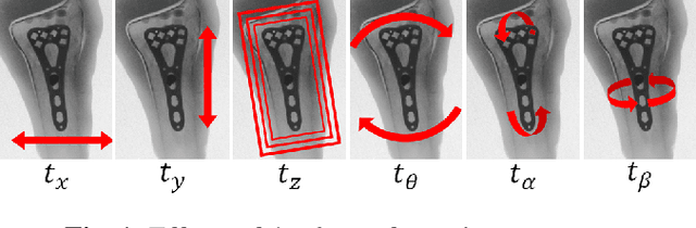 Figure 1 for Real-time 2D/3D Registration via CNN Regression