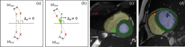 Figure 2 for Comparison of Evaluation Metrics for Landmark Detection in CMR Images