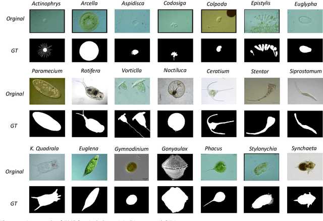 Figure 1 for EMDS-6: Environmental Microorganism Image Dataset Sixth Version for Image Denoising, Segmentation, Feature Extraction, Classification and Detection Methods Evaluation