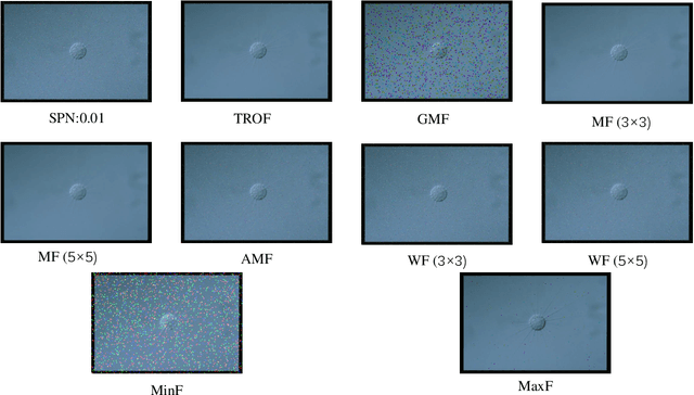 Figure 3 for EMDS-6: Environmental Microorganism Image Dataset Sixth Version for Image Denoising, Segmentation, Feature Extraction, Classification and Detection Methods Evaluation