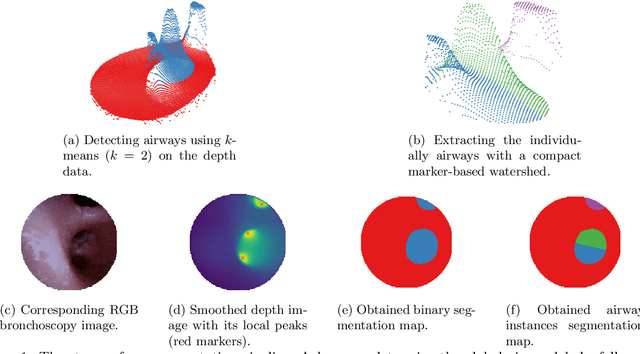 Figure 1 for Weakly Supervised Airway Orifice Segmentation in Video Bronchoscopy