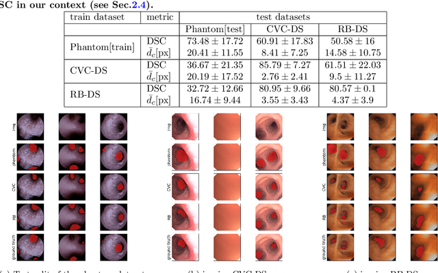 Figure 2 for Weakly Supervised Airway Orifice Segmentation in Video Bronchoscopy