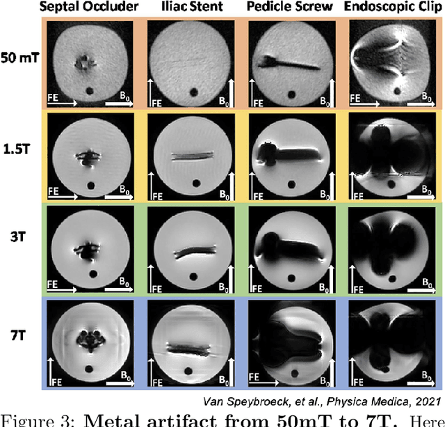 Figure 3 for Off-resonance artifact correction for magnetic resonance imaging: a review