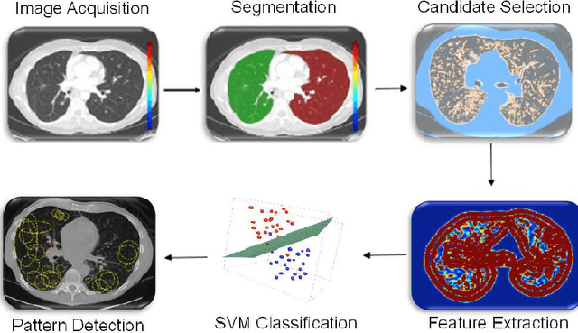 Figure 3 for Learning Shape and Texture Characteristics of CT Tree-in-Bud Opacities for CAD Systems