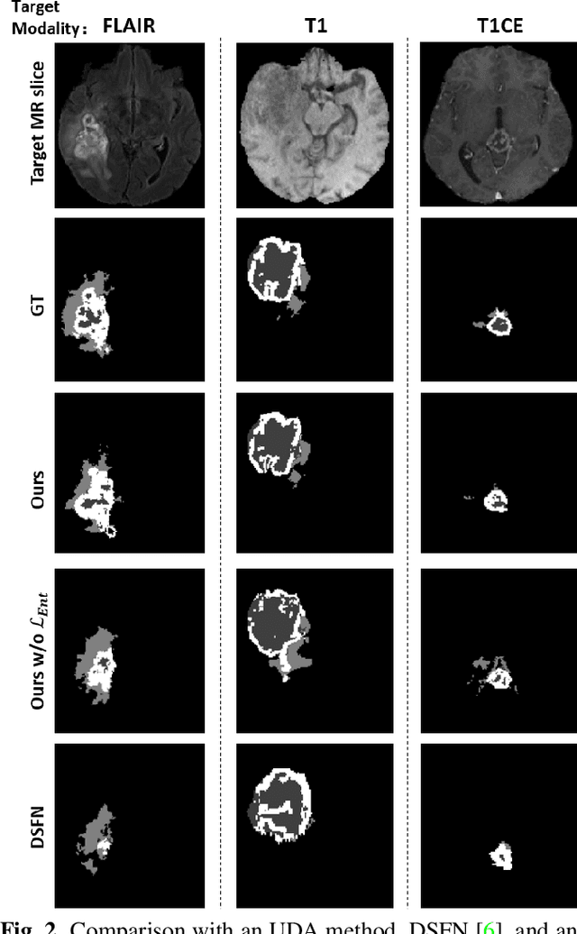 Figure 3 for Self-semantic contour adaptation for cross modality brain tumor segmentation
