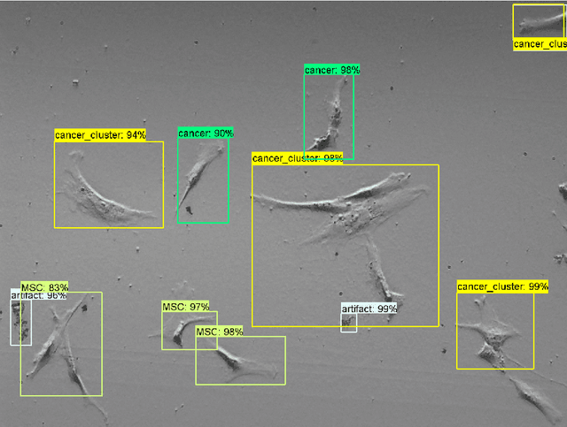 Figure 3 for From Human Mesenchymal Stromal Cells to Osteosarcoma Cells Classification by Deep Learning