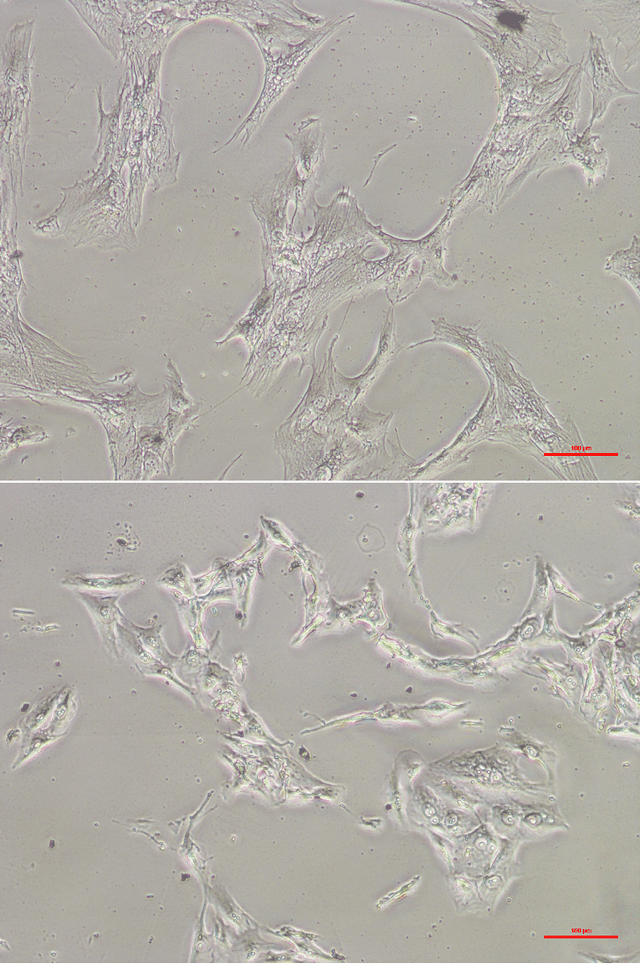 Figure 1 for From Human Mesenchymal Stromal Cells to Osteosarcoma Cells Classification by Deep Learning