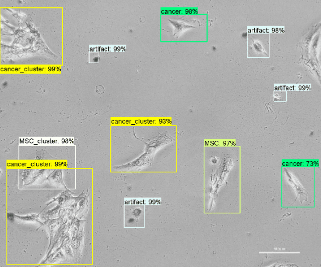 Figure 2 for From Human Mesenchymal Stromal Cells to Osteosarcoma Cells Classification by Deep Learning