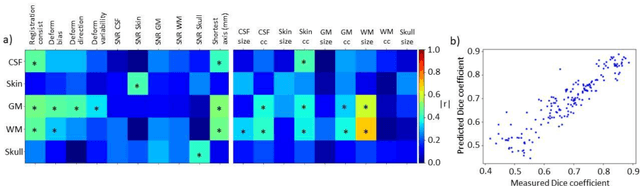Figure 2 for Evaluation of head segmentation quality for treatment planning of tumor treating fields in brain tumors
