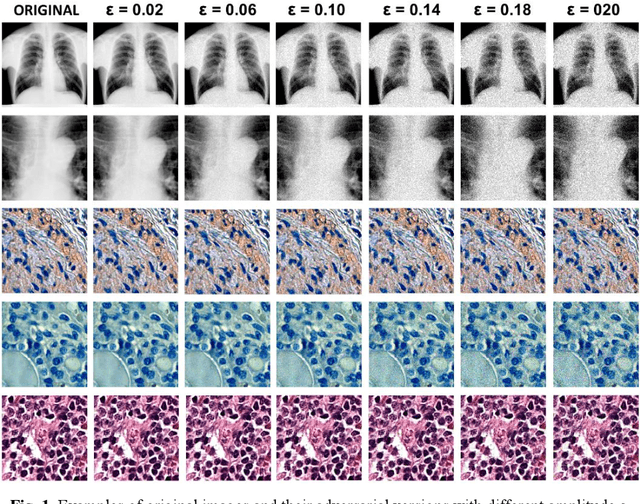 Figure 2 for Influence of Control Parameters and the Size of Biomedical Image Datasets on the Success of Adversarial Attacks