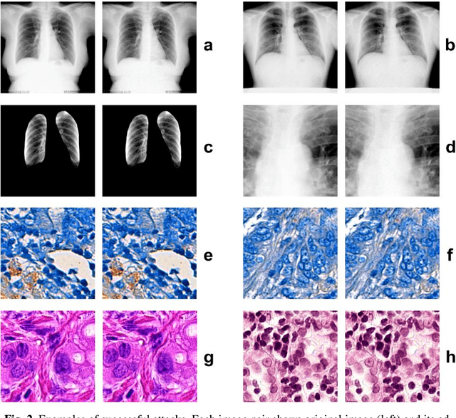 Figure 3 for Influence of Control Parameters and the Size of Biomedical Image Datasets on the Success of Adversarial Attacks