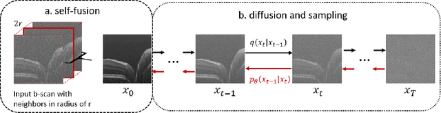 Figure 1 for Unsupervised Denoising of Retinal OCT with Diffusion Probabilistic Model