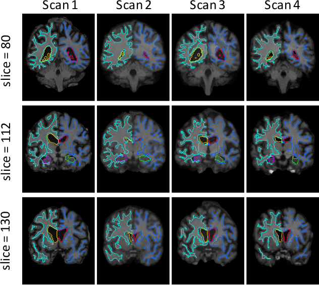 Figure 1 for An Unsupervised Learning Model for Deformable Medical Image Registration