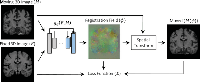 Figure 3 for An Unsupervised Learning Model for Deformable Medical Image Registration