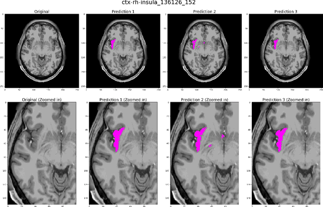 Figure 3 for DARTS: DenseUnet-based Automatic Rapid Tool for brain Segmentation