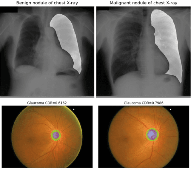 Figure 1 for Combating Ambiguity for Hash-code Learning in Medical Instance Retrieval