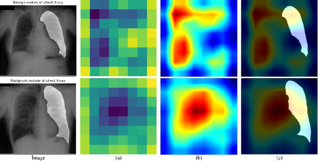 Figure 3 for Combating Ambiguity for Hash-code Learning in Medical Instance Retrieval