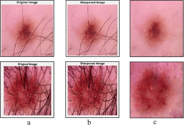 Figure 3 for Advanced Deep Learning Methodologies for Skin Cancer Classification in Prodromal Stages