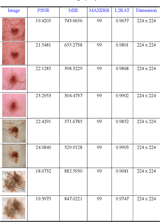 Figure 2 for Advanced Deep Learning Methodologies for Skin Cancer Classification in Prodromal Stages