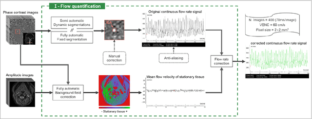 Figure 2 for Flow 2.0 -a flexible, scalable, cross-platform post-processing software for realtime phase contrast sequences