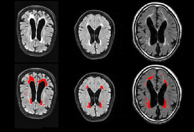 Figure 4 for DeepMRSeg: A convolutional deep neural network for anatomy and abnormality segmentation on MR images