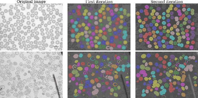 Figure 2 for Analysis of Vision-based Abnormal Red Blood Cell Classification