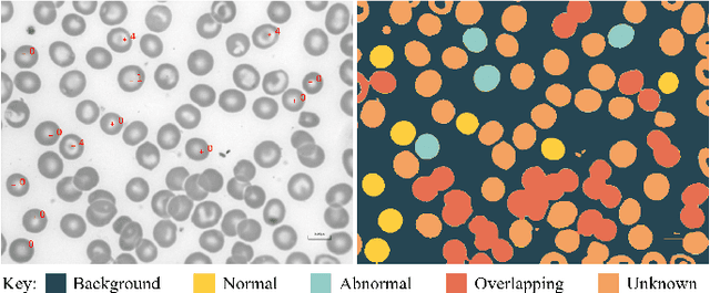 Figure 3 for Analysis of Vision-based Abnormal Red Blood Cell Classification