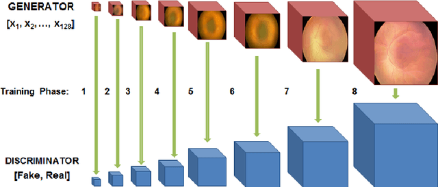 Figure 1 for High-resolution medical image synthesis using progressively grown generative adversarial networks