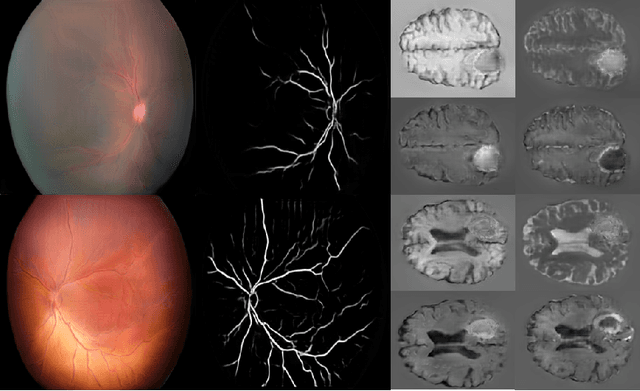 Figure 2 for High-resolution medical image synthesis using progressively grown generative adversarial networks