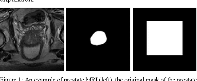 Figure 1 for A new smart-cropping pipeline for prostate segmentation using deep learning networks